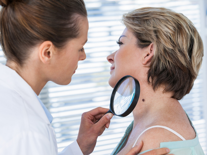 El melanoma es un tipo de cáncer de piel que tiene mayor probabilidad de metástasis. Conoce los principales síntomas factores de riesgo, detección y tratamiento, esto es parte fundamental para sobrellevar la enfermedad.
