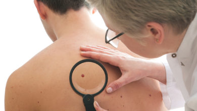 ABC del cáncer cutáneo
