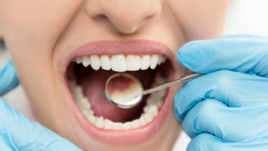 Caries dental