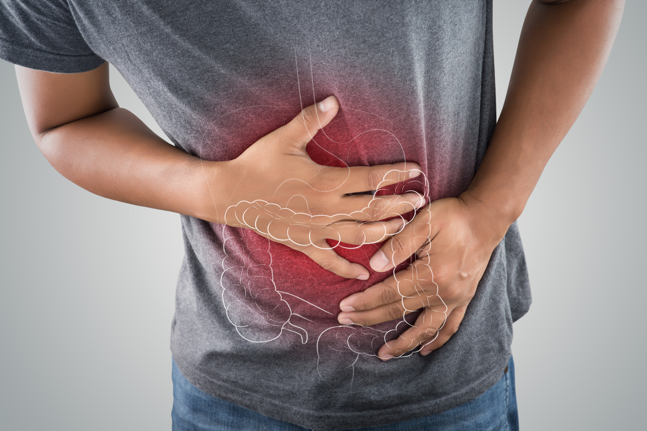 Colitis ulcerosa: síntomas, causas y tratamientos