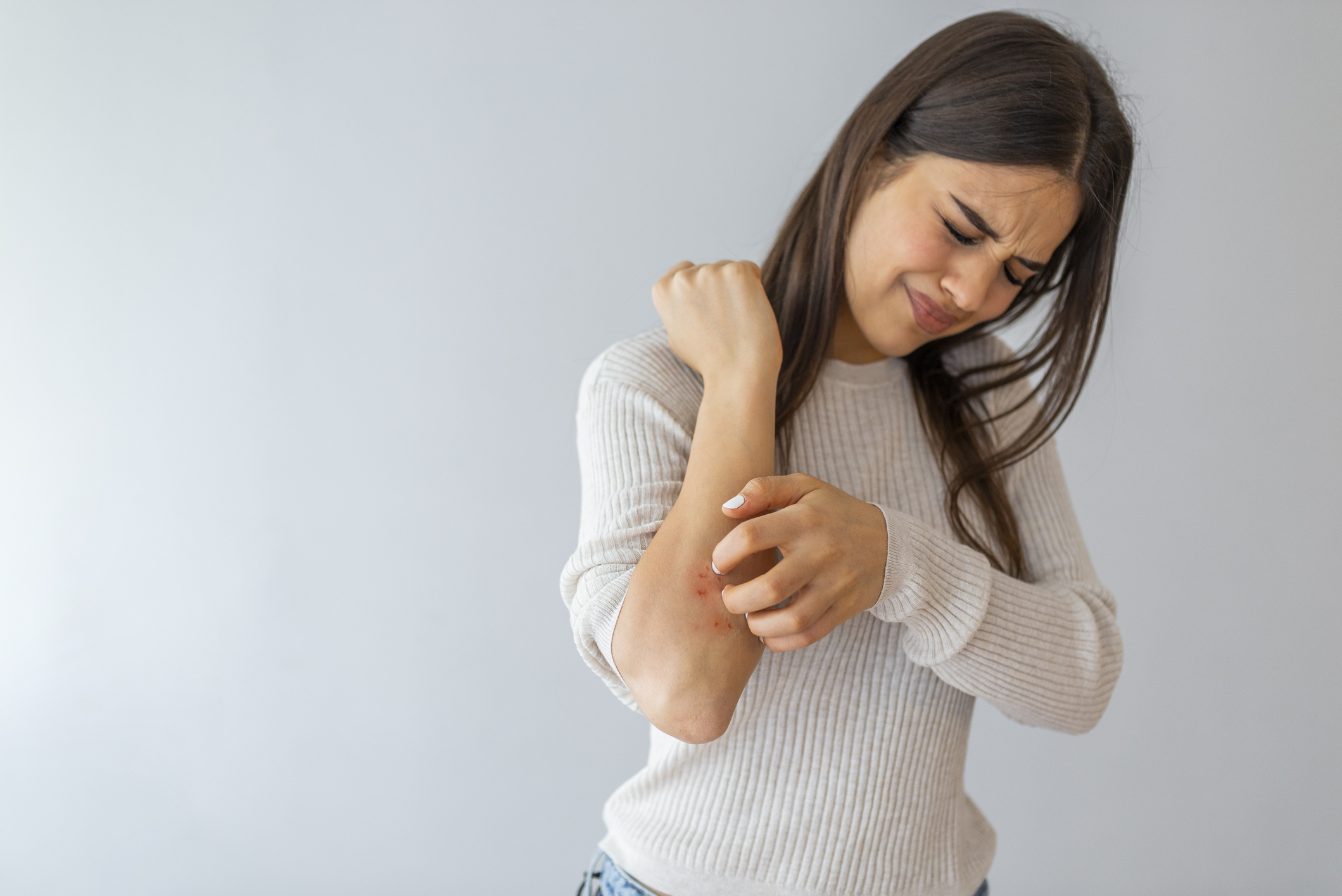 La psoriasis es contagiosa