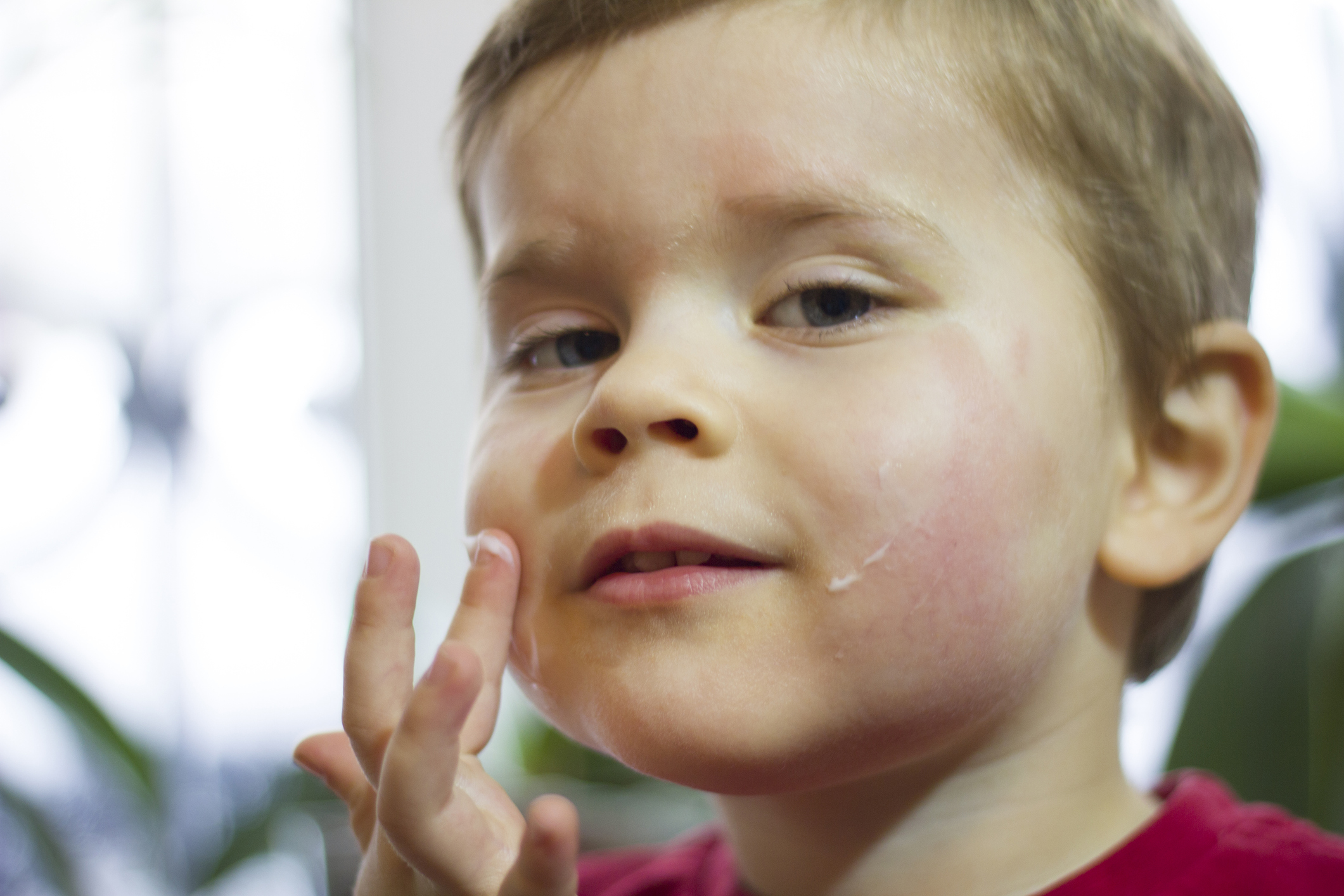Todo lo que necesitas saber sobre la dermatitis atópica