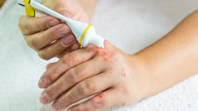 Conoce todos estos tratamientos para el control de la psoriasis
