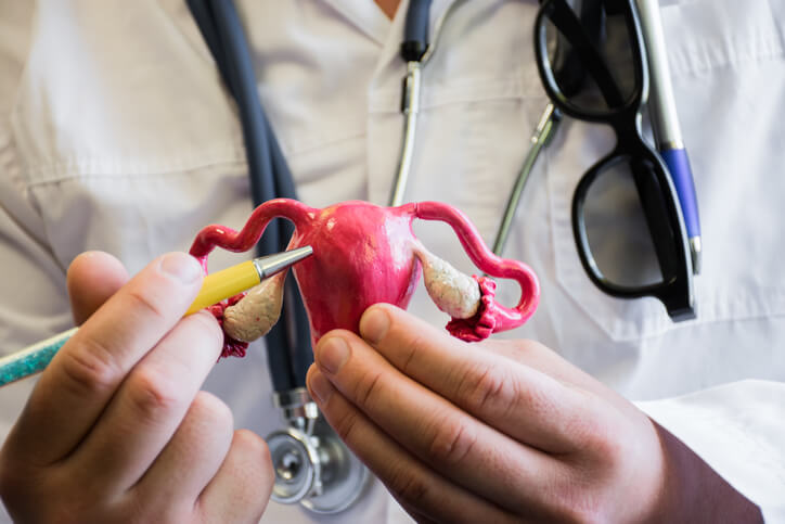Todo lo que debes saber sobre la endometriosis