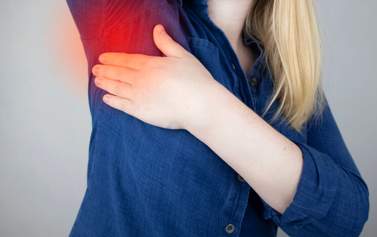 Mujer con hidradenitis supurativa