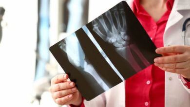 Doctora con radiografía