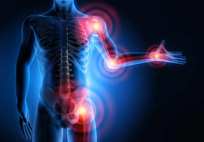 Partes del cuerpo afectadas por las enfermedades reumáticas