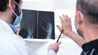 Cuáles son las principales complicaciones desencadenadas por la artritis reumatoide