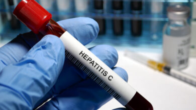Hepatitis C: todo lo que debes saber