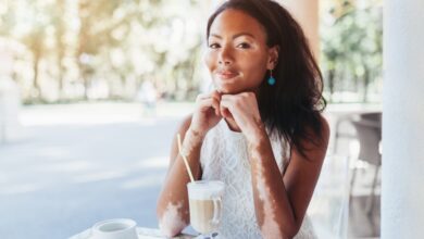 ¿Qué debemos saber sobre el vitiligo