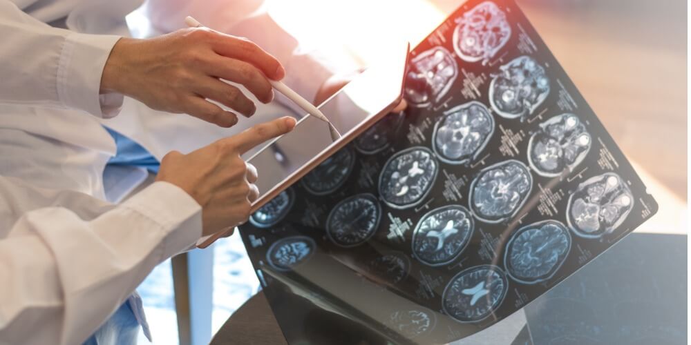 doctores analizando unos resultados de una placa