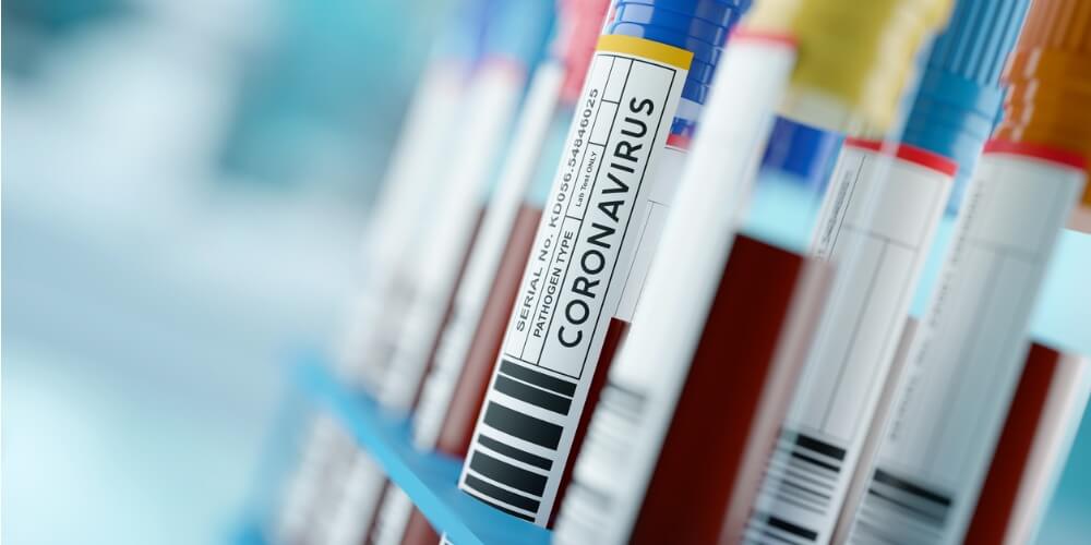 Prueba de covid influenza y micoplasma