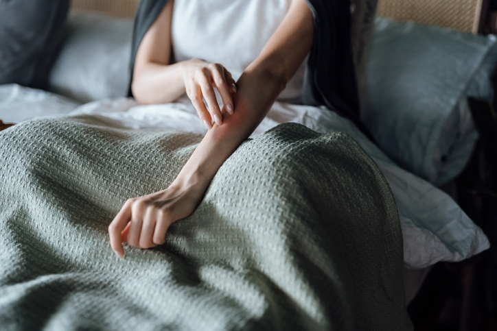 La depresión que padecen los pacientes con psoriasis es más grave que en la población general y se asocia con mayor frecuencia a ansiedad.