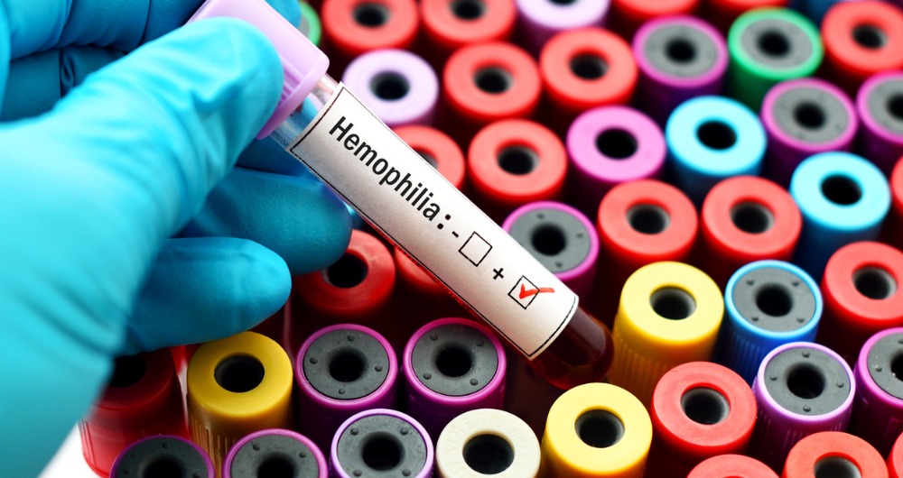 Edúcate sobre la hemofilia y condiciones de sangrado