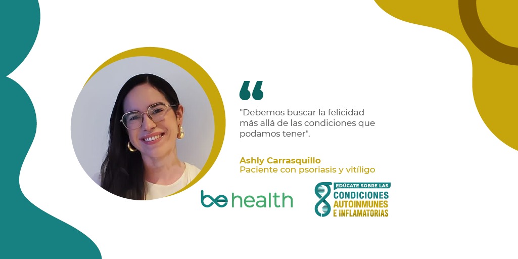 Ashly Carrasquillo, joven boricua que fue diagnosticada con psoriasis y vitíligo