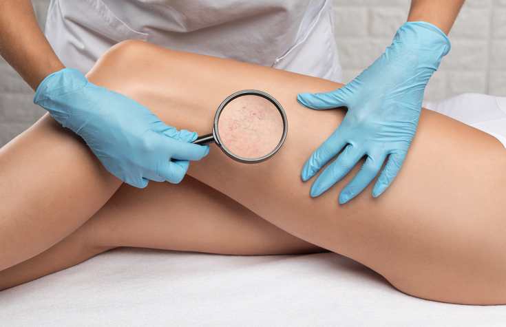 Cómo controlar la anticoagulación en las mujeres