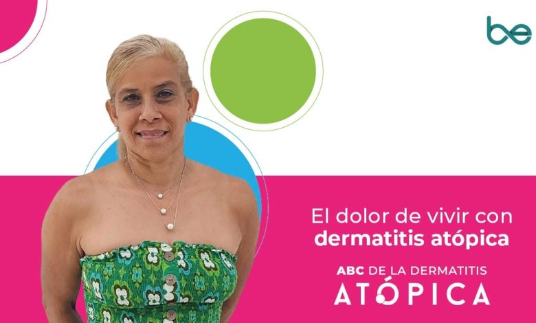 El dolor de vivir con dermatitis atópica