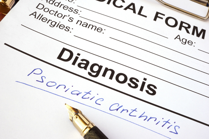 Se estima que aproximadamente el 30% de los pacientes diagnosticados con psoriasis en la isla desarrollarán artritis psoriásica en algún momento de sus vidas.