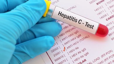 El coordinador de vigilancia de Hepatitis C del Departamento de Salud (DS), Héctor Quiñones Rosaly, dio a conocer las estrategias que se implementan en el programa de vigilancia para cumplir el Plan de Eliminación de la Hepatitis C en 2030.