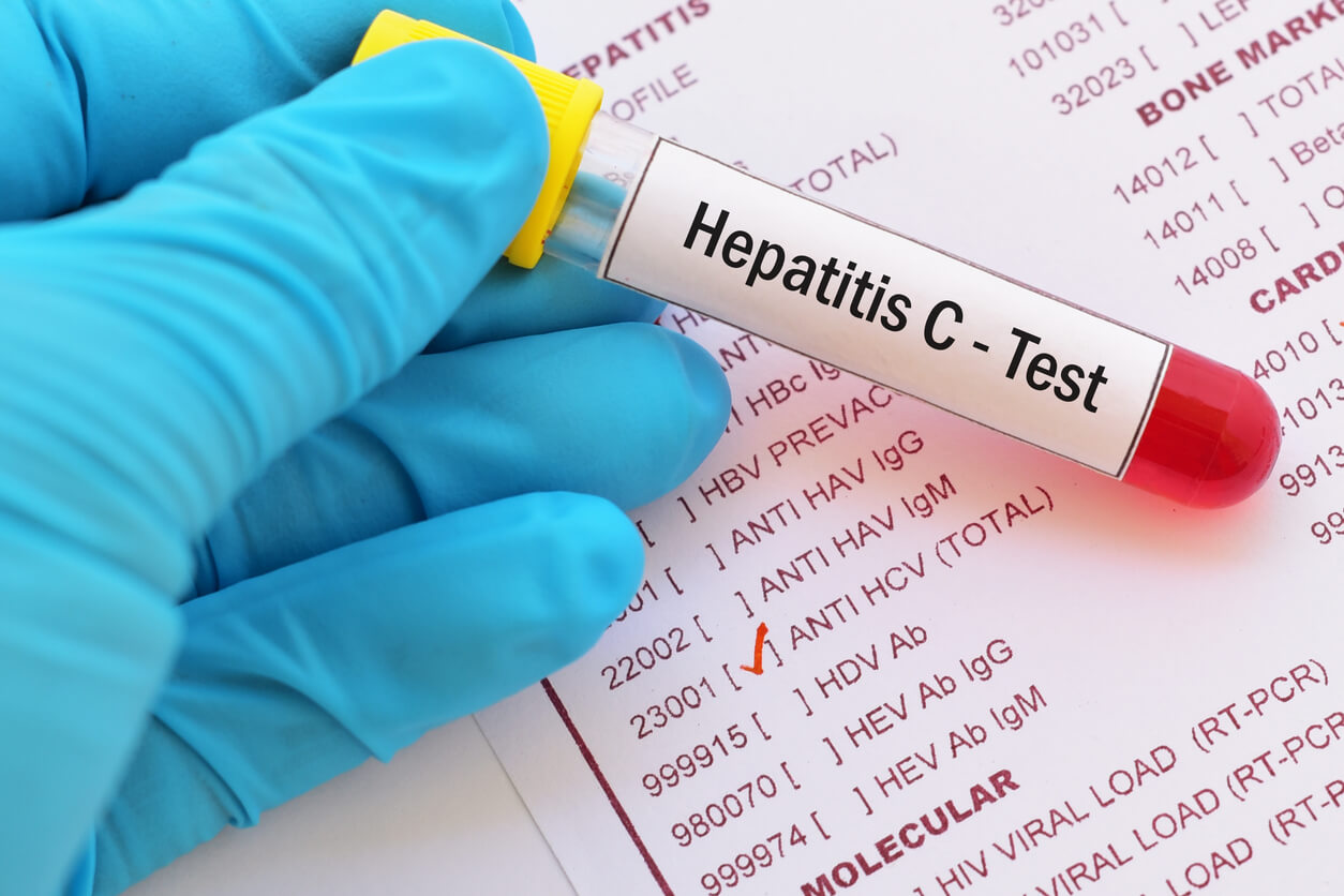 El coordinador de vigilancia de Hepatitis C del Departamento de Salud (DS), Héctor Quiñones Rosaly, dio a conocer las estrategias que se implementan en el programa de vigilancia para cumplir el Plan de Eliminación de la Hepatitis C en 2030.