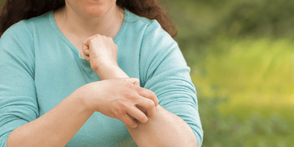 Psoriasis