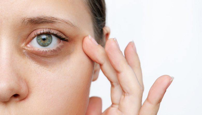 Lo que dicen las ojeras de la dieta