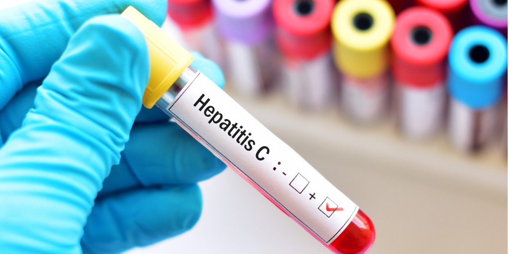 El porcentaje de pacientes examinados con la prueba de detección de anticuerpos para Hepatitis C ha aumentado constantemente cada año.