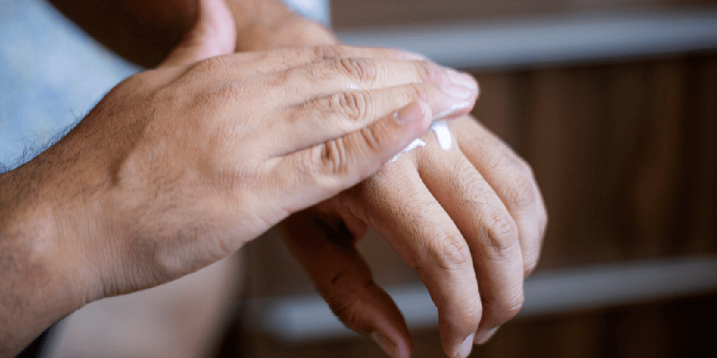 Dermatitis