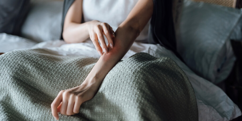 No confundas el prurigo nodular con estas otras condiciones dermatológicas