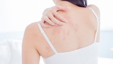 Si experimentas síntomas de prurigo nodular, es importante buscar atención médica para obtener un diagnóstico adecuado.