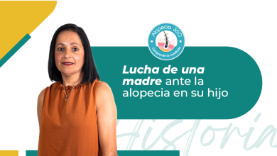 Ivelisse Olivera, la lucha y superación de una madre ante el diagnóstico de alopecia en su hijo