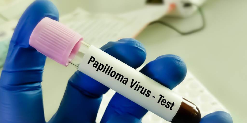 Detección de VPH: su importancia y quiénes deben hacerse la prueba