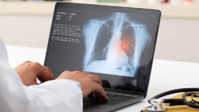 Edema pulmonar