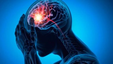 Trastornos circulatorios vertebrobasilares