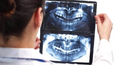 Radiografías dentales
