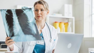 Silicosis