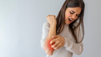 Psoriasis