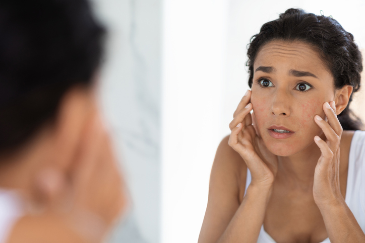 En lugar de minimizar la importancia del eczema, es fundamental ofrecer apoyo, comprensión y empatía a las personas afectadas.
