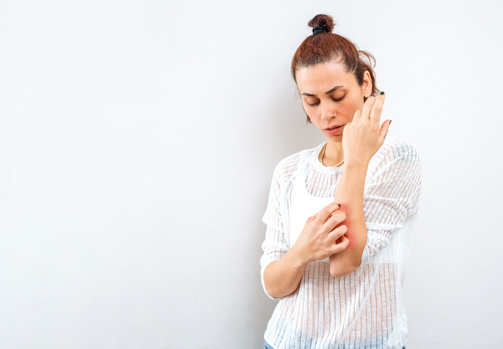 Las principales comorbilidades asociadas a la psoriasis son el síndrome metabólico, artritis psoriásica, enfermedades cardiovasculares, entre otras.