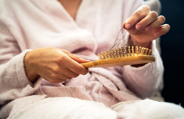 La alopecia areata principalmente afecta el cabello, aunque ocasionalmente puede generar alteraciones en las uñas.