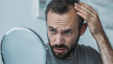 Alopecia es un término genérico que engloba las afecciones caracterizadas por la caída del cabello.