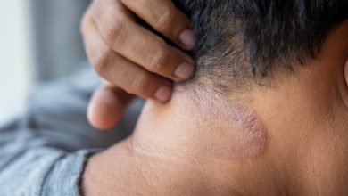 A diferencia de los medicamentos que actúan sobre todo el sistema inmunitario, los biológicos solo bloquean las partes responsables del crecimiento excesivo de células cutáneas.