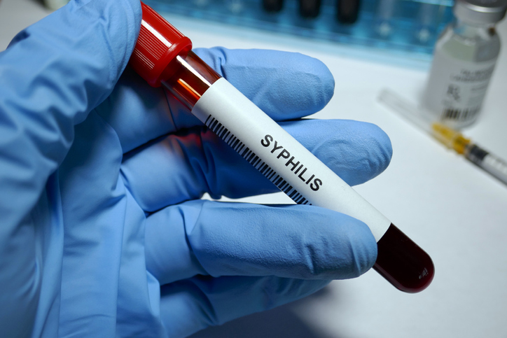 La sífilis es una infección de transmisión sexual (ITS) que se transmite más fácilmente cuando se toca una lesión de sífilis durante las relaciones sexuales.